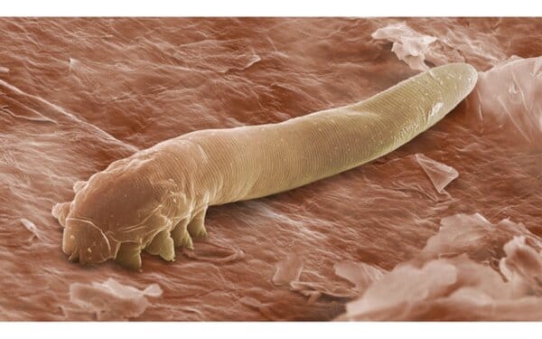 ТРОЙЧАТКА - МОР ЗА ПАРАЗИТИТЕ!