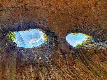 ГЛАУКОМА - ЛЕЧИМА ЛИ Е "ЗЕЛЕНАТА ЗВЕЗДА"?!